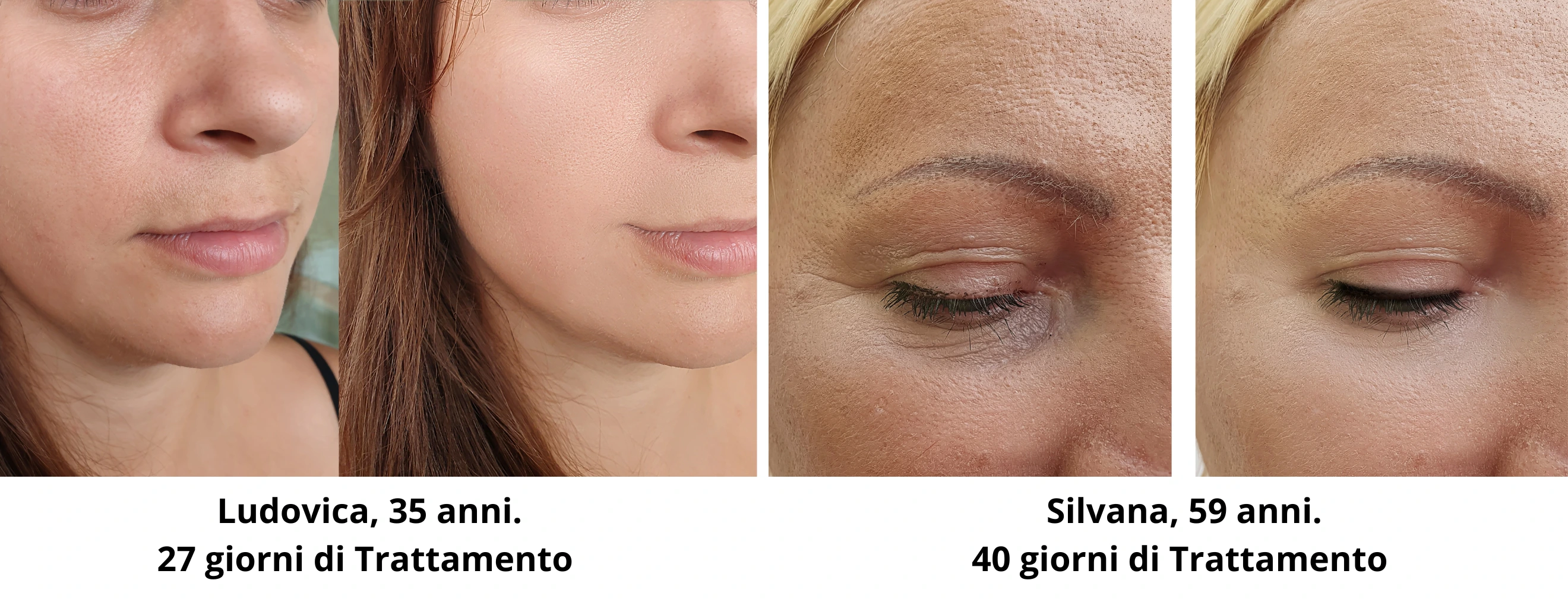 migliora-la-pelle-luminosa-compatta-nutrita-idratata.webp